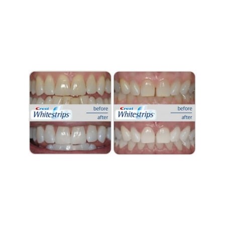 Cutie 12x Plicuri, Benzi Albirea Dintilor, Crest, 3D White, Monthly Whitening Boost, 10% Concentratie, 12 zile