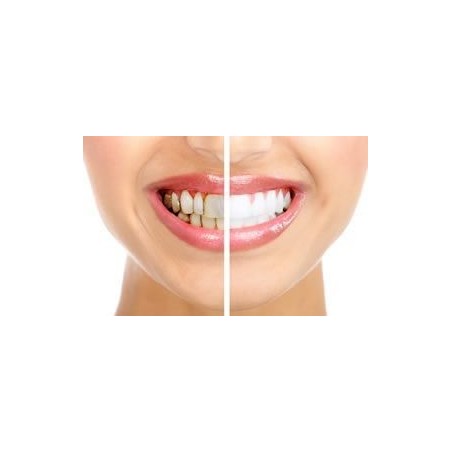 Set 4x Envelopes, Teeth Whitening Strips, Crest 3D White, 1-Hour Express, Whitening Level 12, 4 days