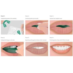 Teeth Whitening Kit, Opalescence, GO! Concentration 6%, Mint Flavor, 10 Molds 2
