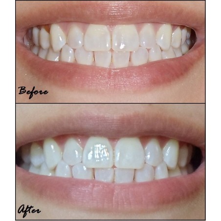 Set 5x Envelopes, Teeth Whitening Strips, Crest 3D Whitestrips, Noticeably White, Whitening Level 7