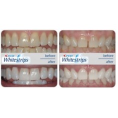 Set 14x Teeth Whitening Strips, Crest 3D White, Glamorous White, 1x Toothpaste 116gr, 1x Mouthwash 946ml 2