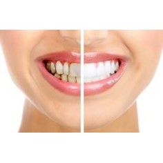Set of 21x Teeth Whitening Strips, Crest 3D White, Supreme Bright, 1x Toothpaste, 110gr, 1x Mouthwash, 1000ml 2