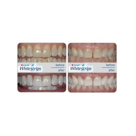 Cutie 12x Plicuri, Benzi Albirea Dintilor, Crest, 3D White, Monthly Whitening Boost, 10% Concentratie, 12 zile
