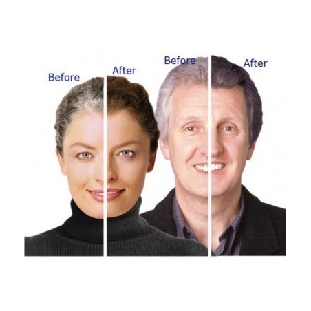 Crema Repigmentare Par Alb, Youthair, Rezultate in 3 Saptamani, Flacon 236ml