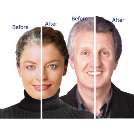 Crema Repigmentare Par Alb, Youthair, Rezultate in 3 Saptamani, Flacon 236ml
