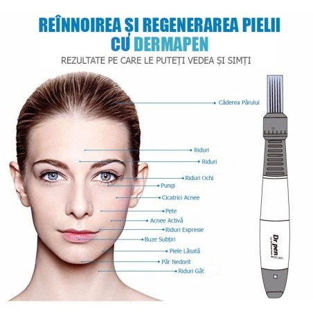 Creion Micro-Ace, Dermapen, Dr. Pen, X5, pentru Electroporare, Wireless, 2x Rezerve 12 ace, Adancime 0.25 - 3.00 mm, 5 viteze